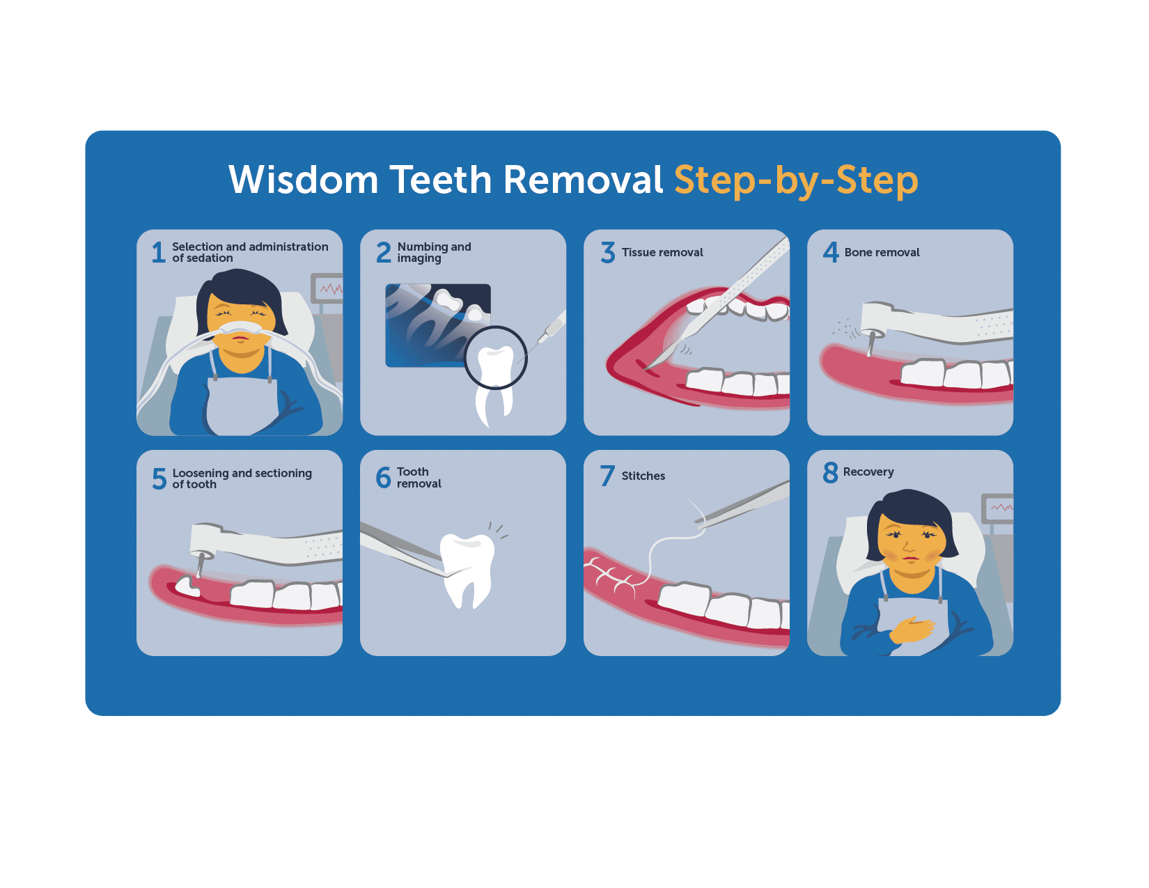 Process of wisdom teeth removal
