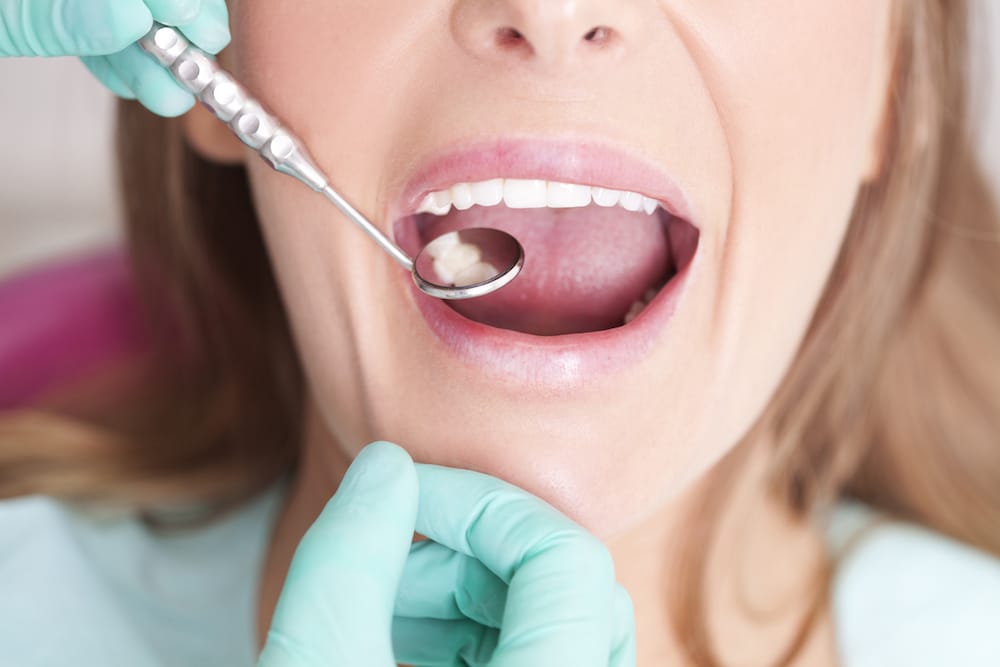 Header Image for Root Canal Blog