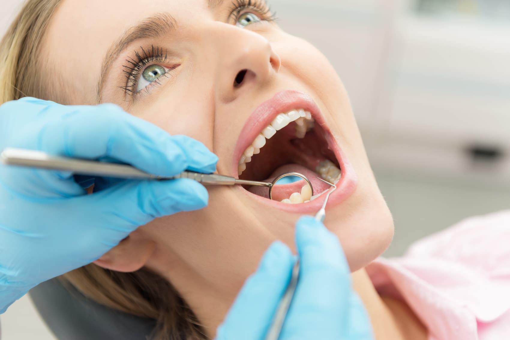 dental crowns blog image