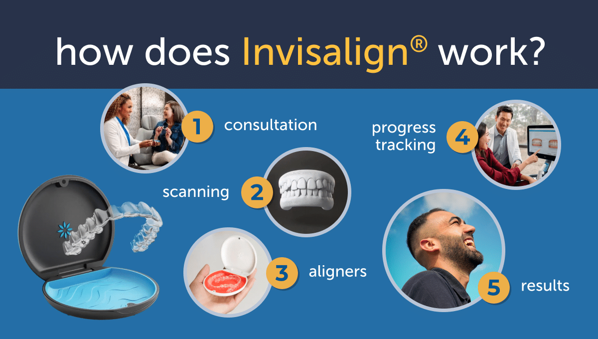 How does Invisalign work?